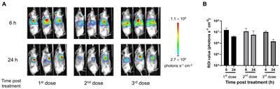 Local administration of mRNA encoding cytokine cocktail confers potent anti-tumor immunity